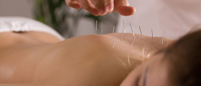 Four ways acupuncture helps relieve stress to office workers