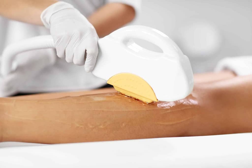 Why are people using IPL hair removal?