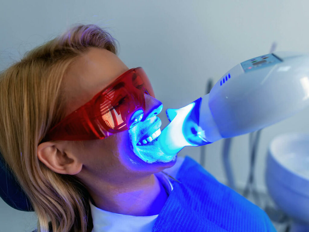 How can teeth whitening be beneficial for you?